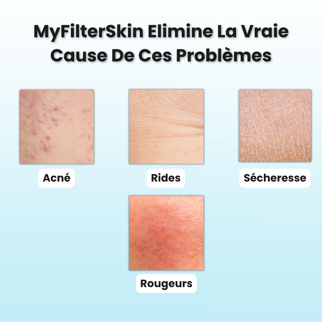 MyFilterSkin Lavabo
