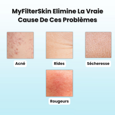 MyFilterSkin Lavabo